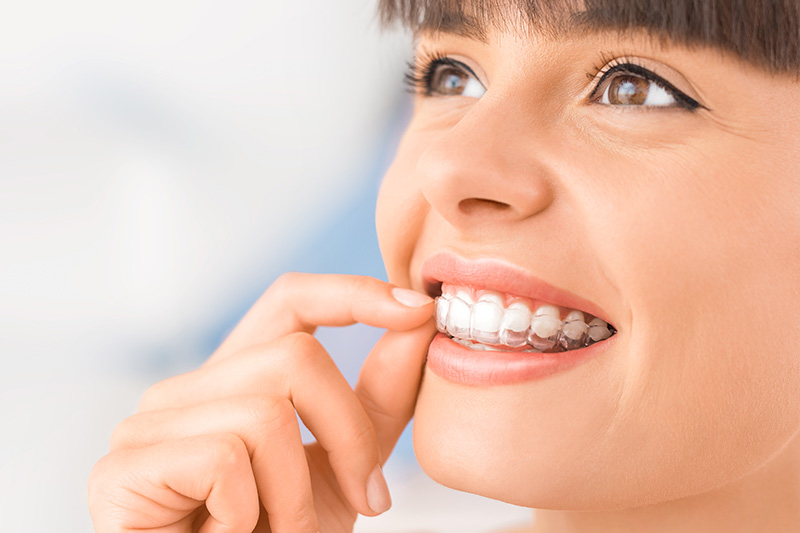 Invisalign in Bakersfield