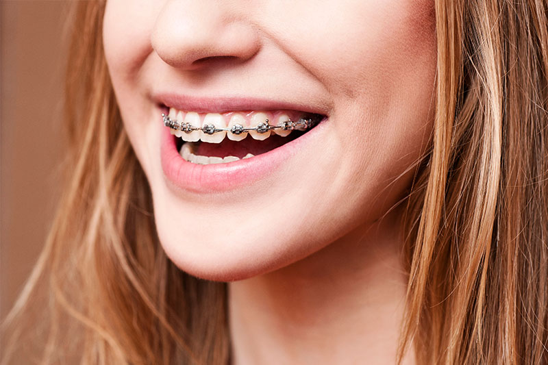 Orthodontics in Bakersfield